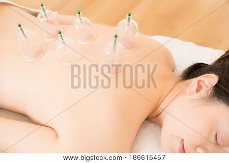 Lying On Chest With Cupping Treatment