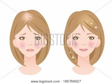 woman with hair loss before and after. female healthy hair and thinning hair
