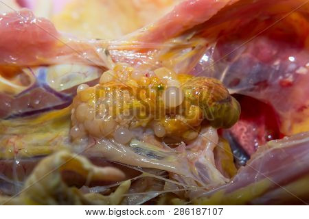 Cystic Ovarian Degeneration In  Adult Chicken At Necropsy