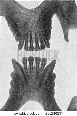 The development stages of maxillary orang views from inside, vintage X-ray. From the Universe and Humanity, 1910.
