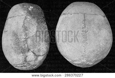 Dolichocephalic skull of a Loango african and a Finnish brachycephalic skull, vintage photo. From the Universe and Humanity, 1910.
