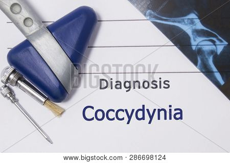 Neurological Diagnosis Of Coccydynia. Neurologist Directory, Where Is Printed Diagnosis Coccydynia, 