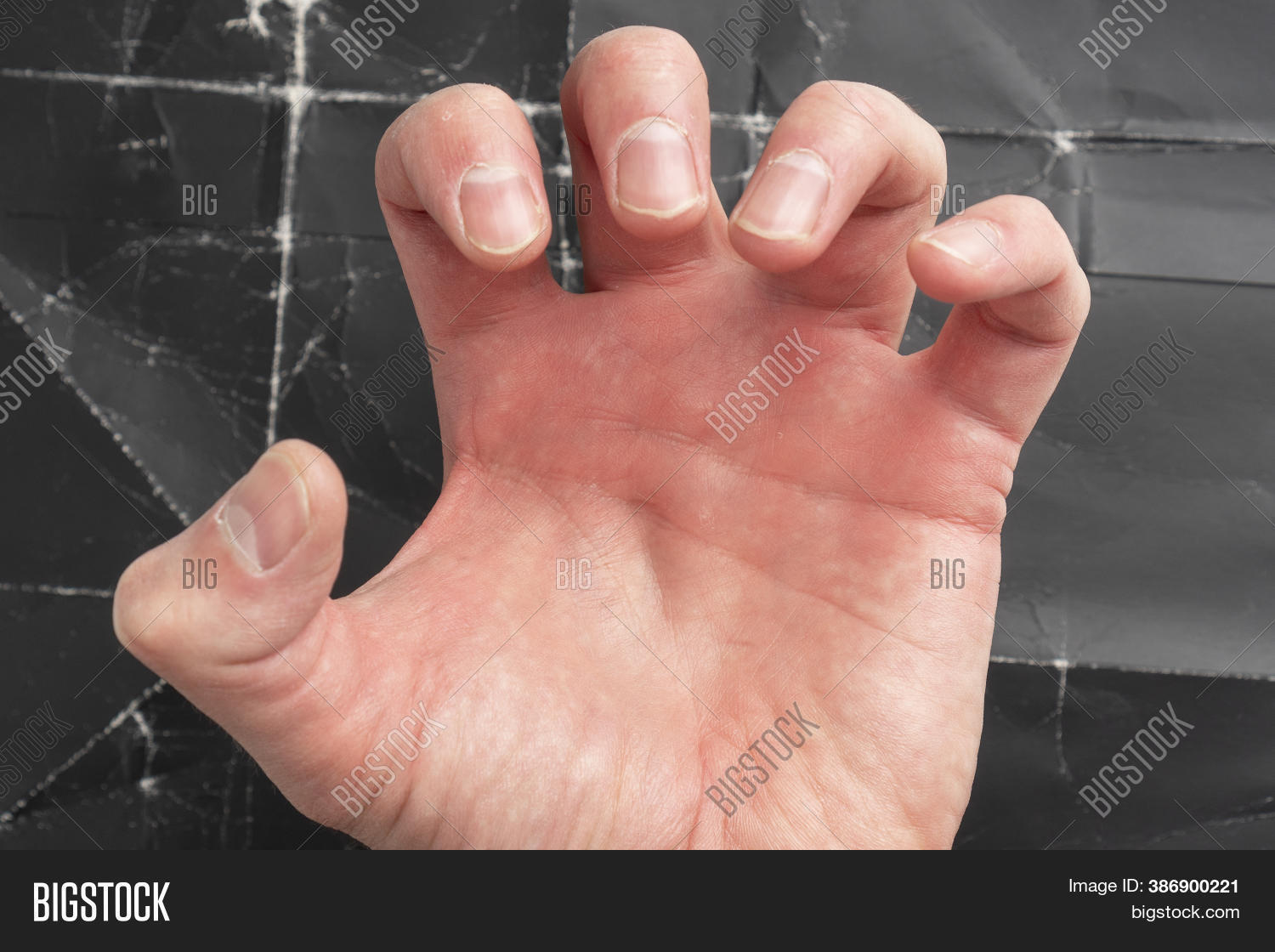 Man Gripped His Hand Image & Photo (Free Trial) | Bigstock