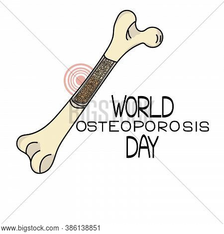 World Osteoporosis Day, Schematic Representation Of The Bone, The Internal Structure Of The Bone Wit