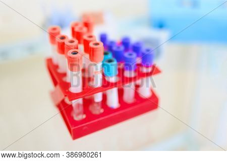 Laboratory Test Tubes With Tests For Research. A Set Of Test Tubes With Different Biomaterials For S
