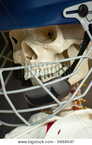 Lesioni di sport estremi