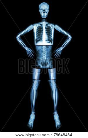 Human Bone Stand And Akimbo