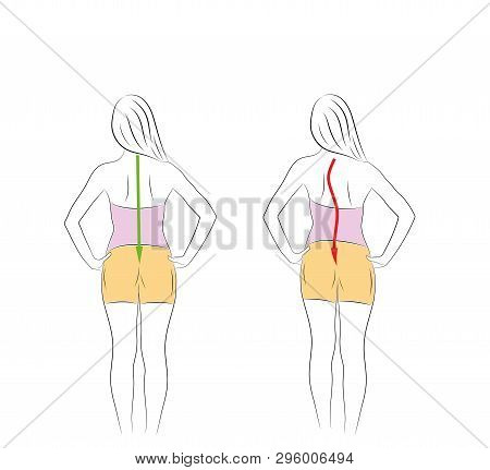 Correct Alignment Of Human Body In Standing Posture For Good Personality And Healthy Of Spine And Bo