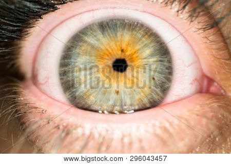 Macro Shot Of Woman Eyeball With Small Pupil. Close Up Of Female Eye Ball