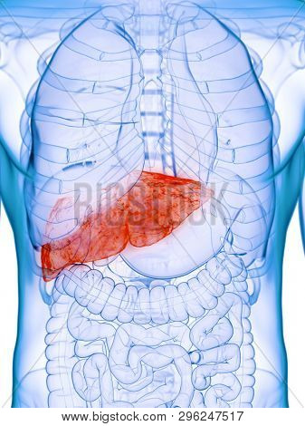 3d rendered medically accurate illustration of a diseased liver