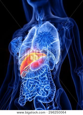3d rendered medically accurate illustration of a womans liver tumor
