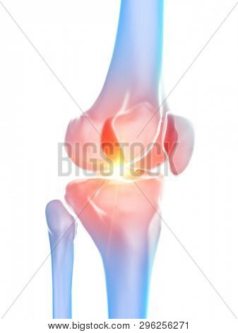 3d rendered medically accurate illustration of the knee joint showing pain