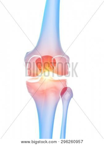 3d rendered medically accurate illustration of the knee joint showing pain