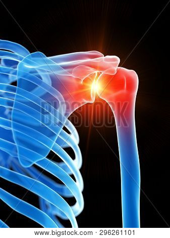 3d rendered medically accurate illustration of the shoulder joint showing pain