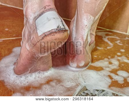 Big Plaster Cover Blister On Human Heel In Shower. Wet Bloody Painful Skin On Man Foot With Adhesive