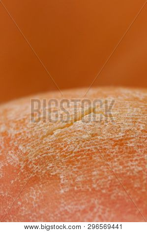 Closeup Image Of Old Callus With Crack.