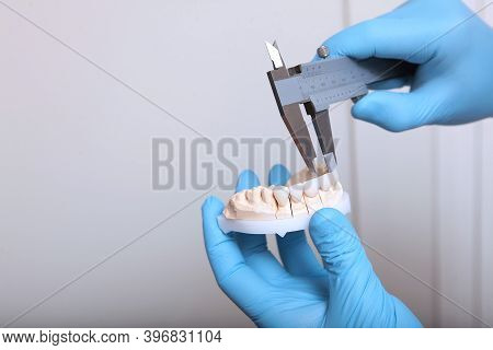 A Dental Technician Makes The Measurement Of The Veneers. Ceramic And Composite Veneers. Hands In Pr