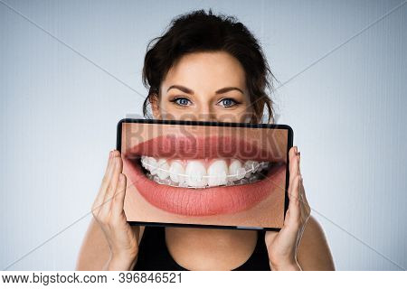 Fund Woman Portrait With Dental Braces And Tablet