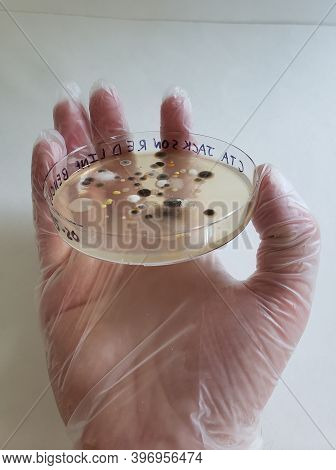 A Gloved Latex Hand Holding A Petri Dish With Growing Cultures Of Microorganisms, Fungi And Microbes