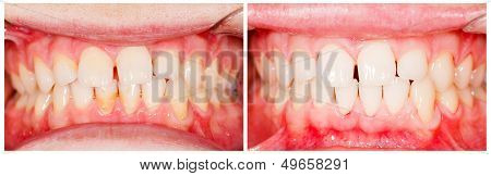 Beforea And After Treatment