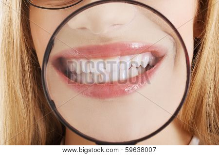 Close up on business woman's teeth through magnyfying glass.