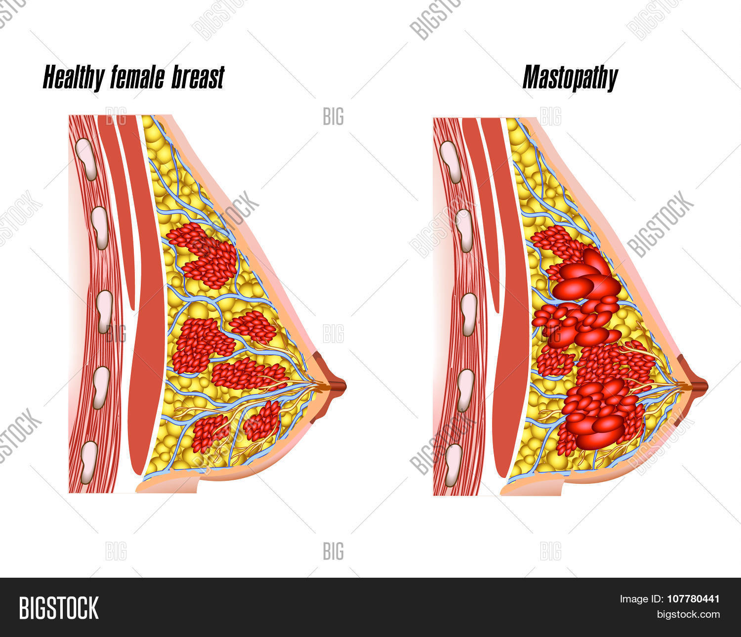 Anatomy Female Breast Vector & Photo (Free Trial) Bigstock