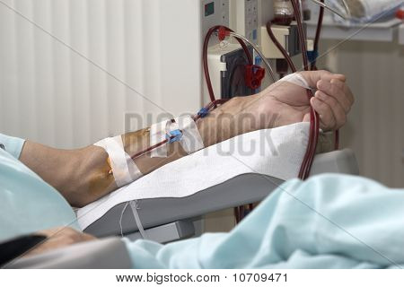Dialyse Health Care Geneeskunde nier