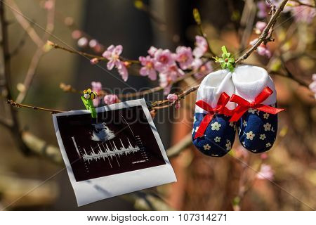 Baby Slippers And Ultrasound Image Hanging On A Branch Of Blossoming Tree