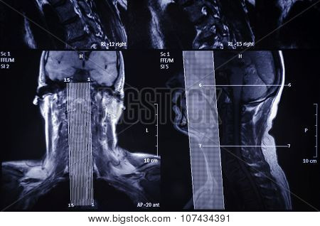 Mri Scan