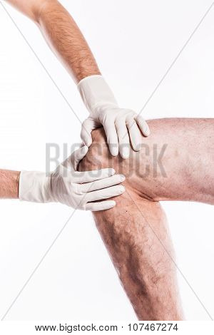 Doctor In Medical Gloves Examines A Person With Varicose Veins Of The Lower Extremities And Venous T