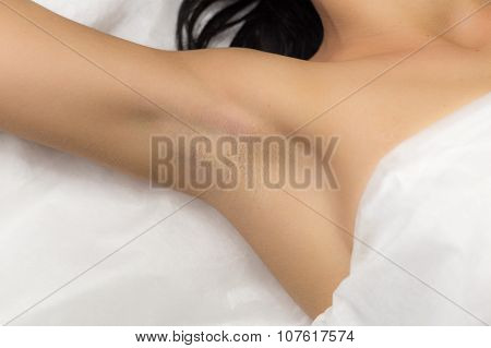 Underarm girl client after laser hair removal