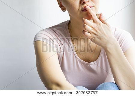 Red Bubbles Of Virus Herpes On Lips Of A Woman In Light Pink T-shirt, Lower Part Face Is Seen, Which