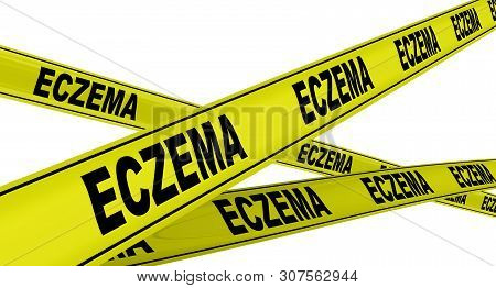 Eczema. Yellow Warning Tapes With Black Words Eczema (eczema Is A Group Of Diseases That Results In 
