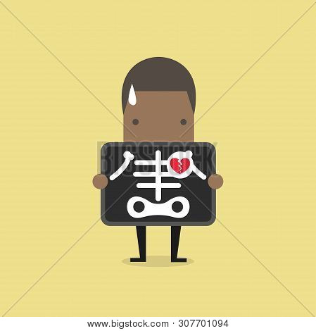 African Businessman Broken Heart With X-ray Scan, Heartbreak.