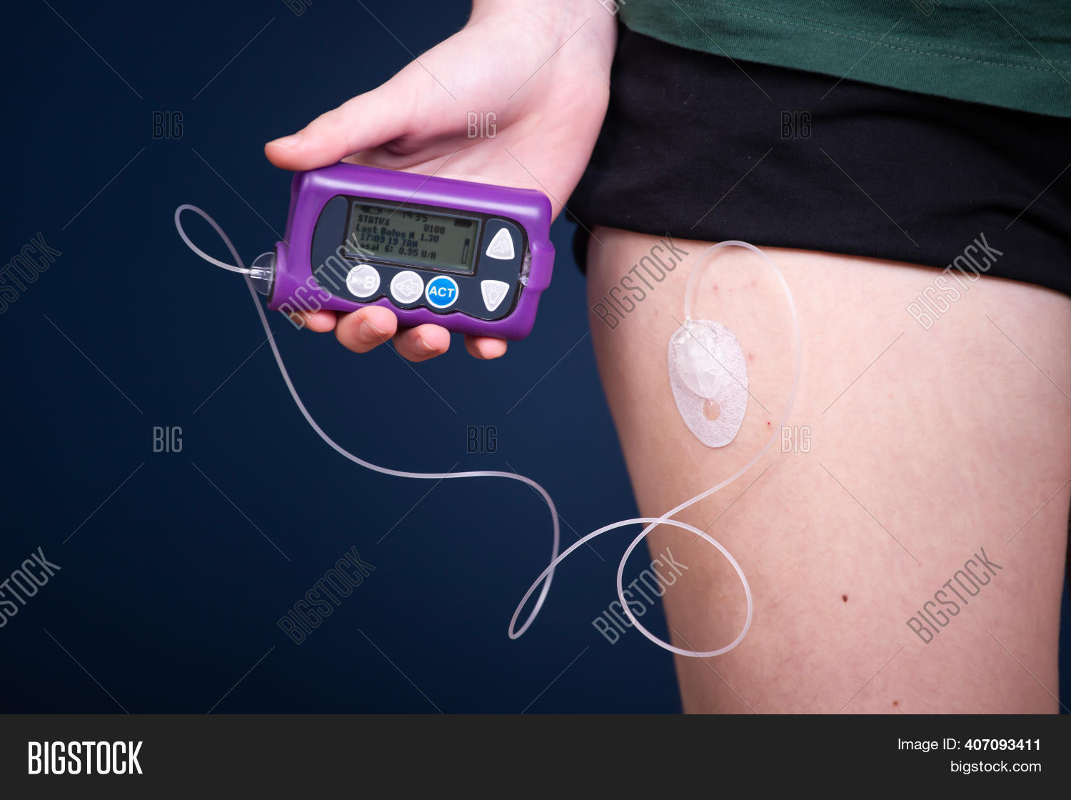 Close View Diabetic Image & Photo (Free Trial) Bigstock