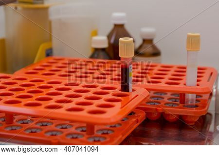 Vacutainer With Human Blood Is In A Special Tray