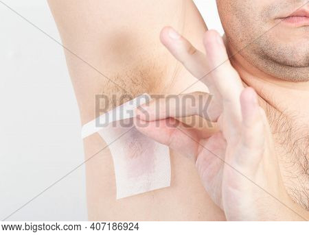 A Man Removes Hair From His Armpit With Wax Depilatory Strips, Close-up. Hygienic And Cosmetic Proce