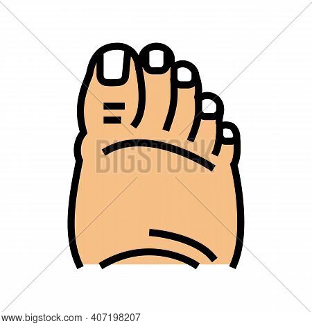 Fatty Foot Edema Color Icon Vector. Fatty Foot Edema Sign. Isolated Symbol Illustration
