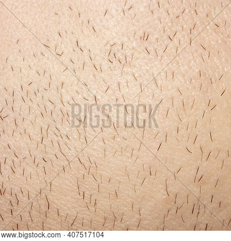 Unshaven Stubble On A Man's Face.part Of An Unshaven Male Face.photo Of Male Bristles.