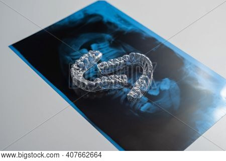 Transparent Bite Correction Trays And X-ray Of The Jaw. Orthodontist Equipment