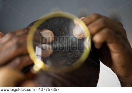 Dermatologist Doctor Examining Itchy Lost African Hair