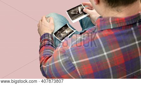 A Patient With An Ultrasound Of The Prostate In His Hands Is Studying His Disease, A Young Man In A 