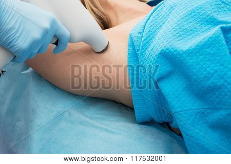 Procedure against hyperhidrosis