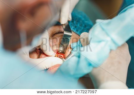 Male Old Professional Dentist Surgeon In Uniform And Female Assistant Helps To Performing Operation