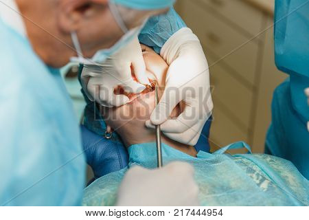 Close Up Process Of Male Professional Dentist Surgeon Performing Operation Install Dental Implant Te