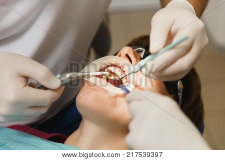 Process Of Preparing And Installing Dental Ceramic Crown. Male Professional Dentist And Female Assis