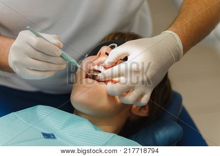 Process Of Preparing And Installing Dental Ceramic Crown. Male Professional Dentist And Female Assis