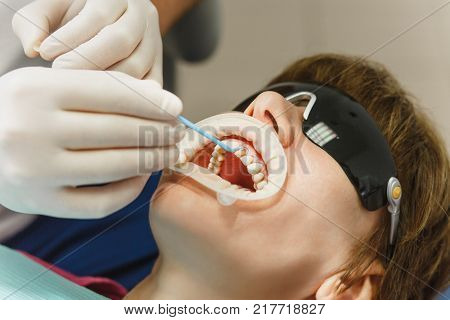Process Of Preparing And Installing Dental Ceramic Crown. Male Professional Dentist And Female Assis