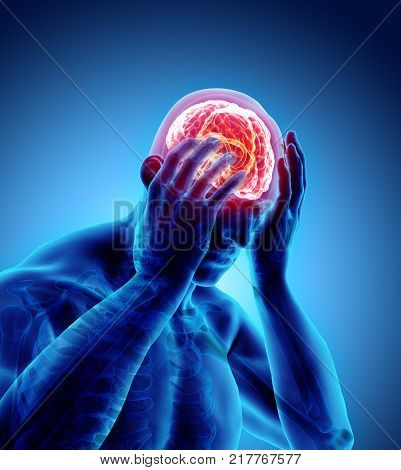 3D Illustration Of Headache Human.