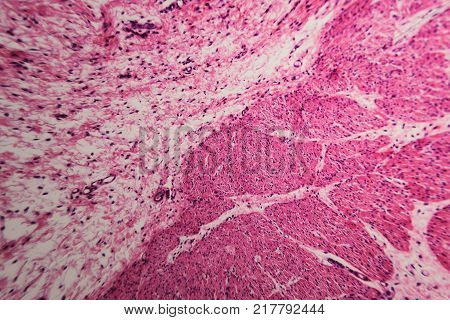 Cell Microscopic- Pyloric Division Stomach